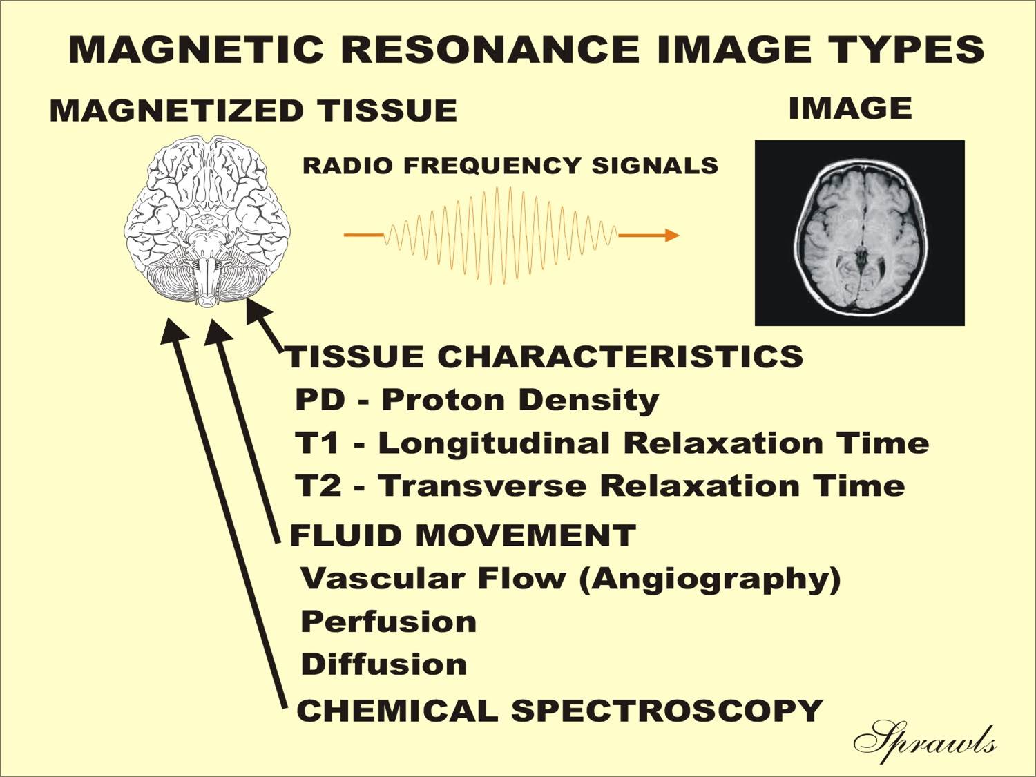Resonance Image Characteristics